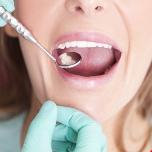 One Million US Dental Patients Impacted by Data Breach